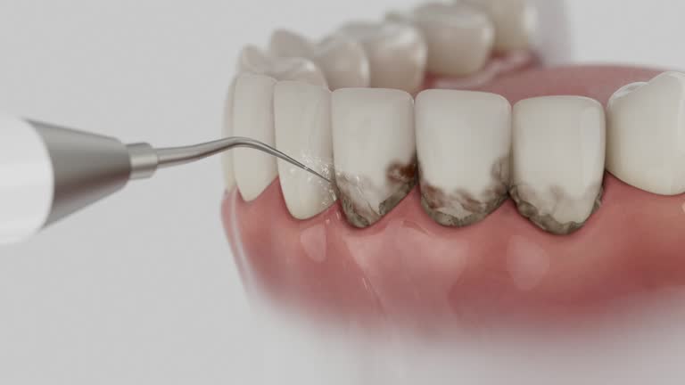 Trusted Teeth Cleaning And Checkup service in Ben Avon, PA - Dentist Open Now